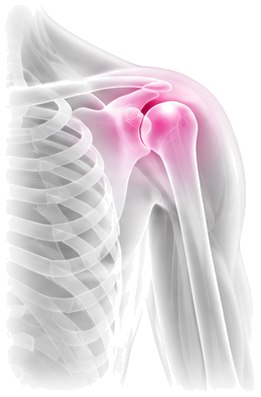 X-ray style view of the shoulder